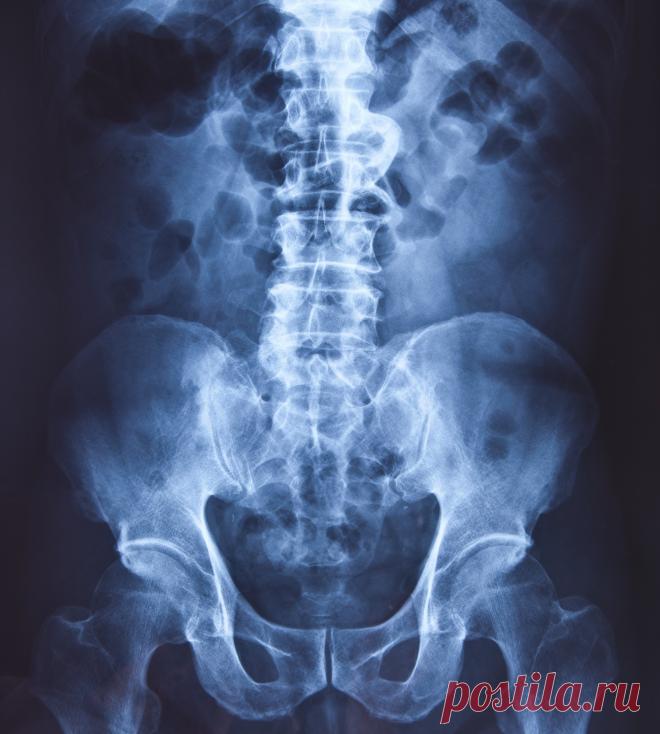 Лечение болезней тазобедренных суставов в Германии