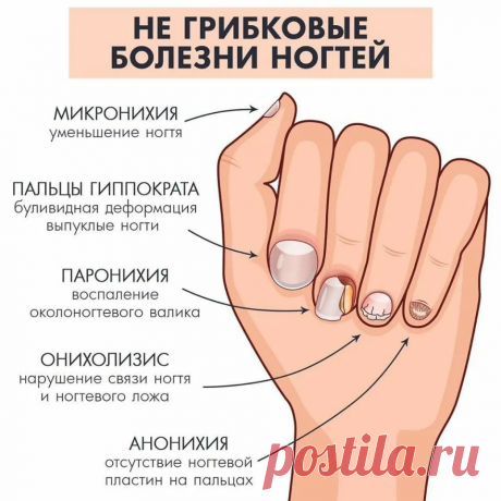 Посмотрите на свои ногти: вот что можно по их изменениям сказать о вашем здоровье | О здоровье: с медицинского на русский | Дзен