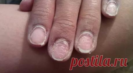 Чем грозит гель-лак вашим ногтям. Прочесть всем! Страшный факт о гель-лаке! Наращивание ногтей гель-лаком — модная процедура, ведь держится такой маникюр до 3-х недель. Он мог бы и дольше. только ногти