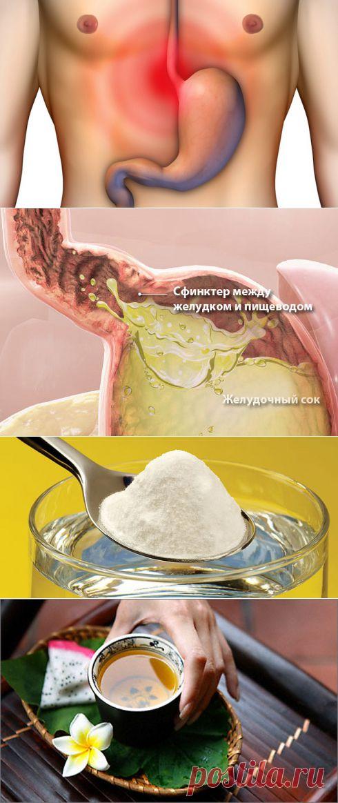 Как помочь себе при изжоге - Делимся советами