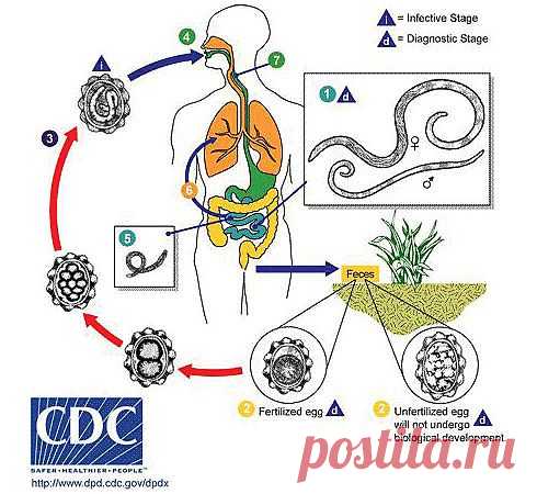 Что такое аскаридоз? 
Аскаридоз – распространенная глистная инвазия, которая встречается среди населения всех возрастов. Возбудителем данного заболевания является круглый червь аскарида.