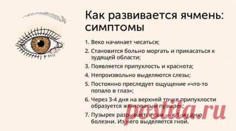Что такое ячмень на глазу - причины, симптомы, лечение и профилактика