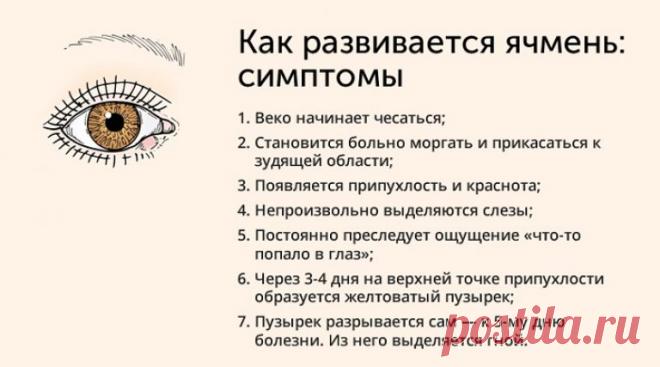 Что такое ячмень на глазу - причины, симптомы, лечение и профилактика
