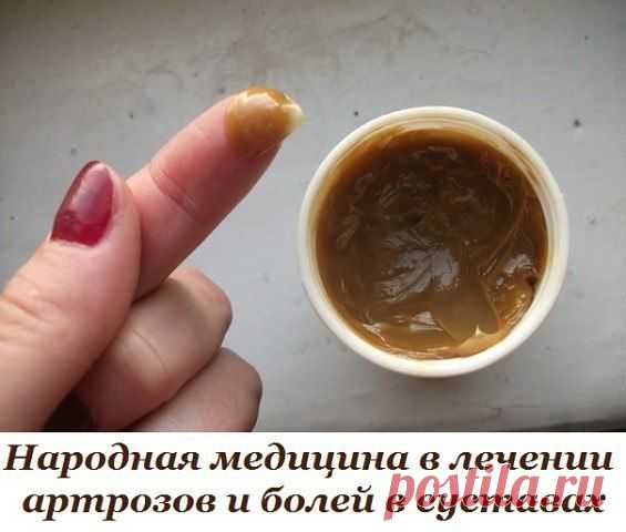 Народная медицина в лечении артрозов и болей в суставах.
