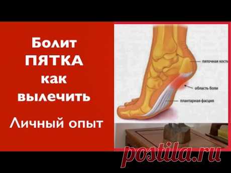 Болит пятка. Больно наступать на пятку. Как избавиться от боли. Все средства и упражнения.