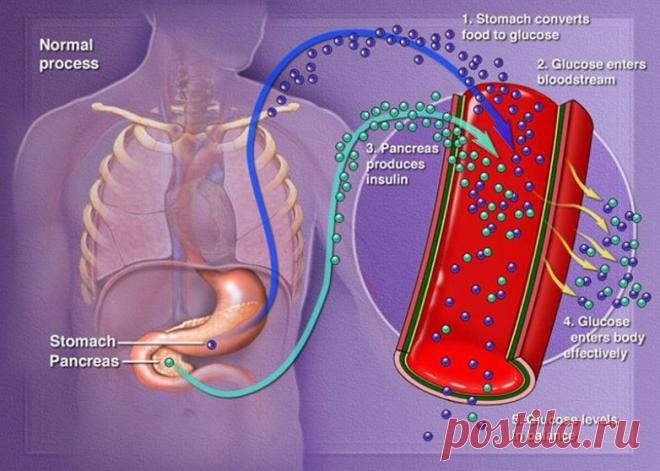 Сигналы о том, что уровень сахара в крови очень высок / Будьте здоровы