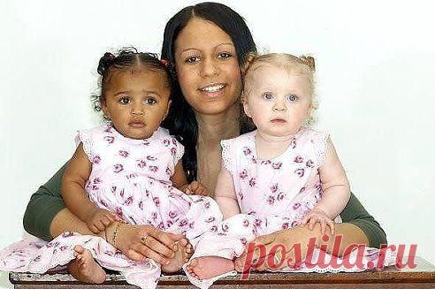 Девочки-двойняшки. Бывает и такое!