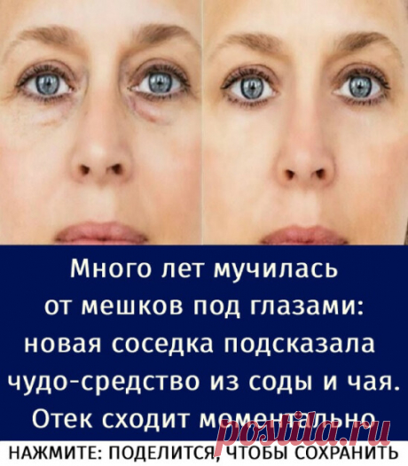 Много лет мучилась от мешков под глазами: новая соседка подсказала чудо-средство из соды и чая. Отек сходит моментально