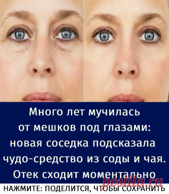 Много лет мучилась от мешков под глазами: новая соседка подсказала чудо-средство из соды и чая. Отек сходит моментально