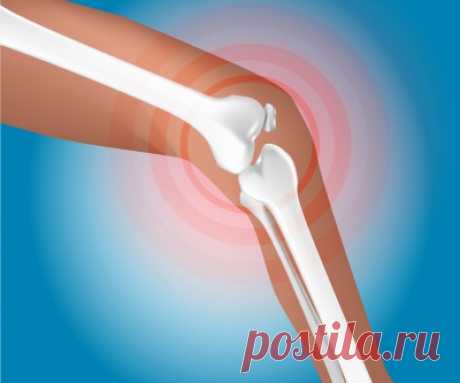 12 metód prírodnej liečby a znižovania bolestí pri reume a artritíde | Badatel.net