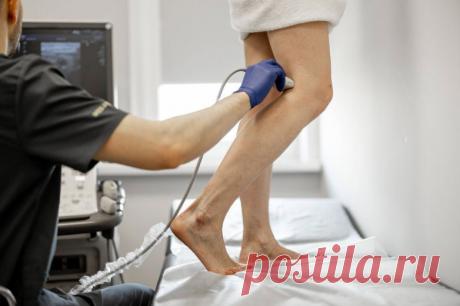 Что такое склеротерапия? Бороться с варикозным расширением вен можно по разному. Склеротерапия — один из методов. Когда он применяется?