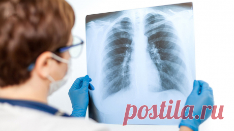 Фиброз легких: лечение, симптомы, причины Как лечить фиброз легких? Симптомы, причины и продолжительность легочного фиброза.