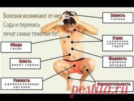 Сода и Перекись Водорода лечат самые тяжелейшие белезни