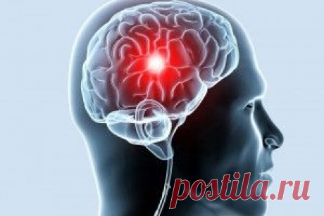 Инсульт - Головная боль. Причины, симптомы и лечение.