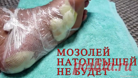 Это невероятно! МОЗОЛИ и НАТОПТЫШИ исчезнут за ВЕЧЕР Друзья, два способа избавиться от натоптышей и мозолей на ногах.&nbsp;Первый способ, это при помощи уксуса и лука, второй - покупной, ниже ссылки, где можно приобрести.