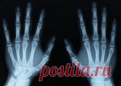 Катаракта - симптомы. Катаракта - лечение, причины, профилактика :: SYL.ru