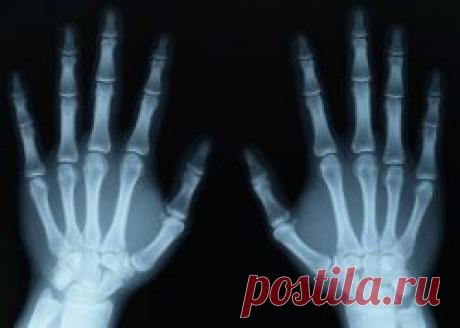 Катаракта - симптомы. Катаракта - лечение, причины, профилактика :: SYL.ru