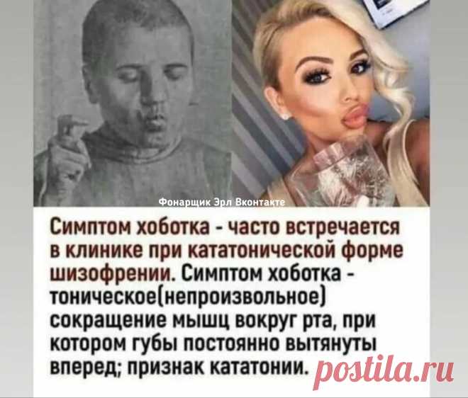ЗВЕЗДЫ ДО и ПОСЛЕ ПЛАСТИКИ ГУБ | Знаменитости и звезды шоу-биза | Дзен