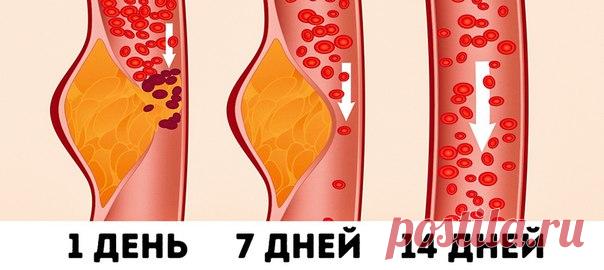 Что такое DASH-диета и почему, по оценкам врачей, она считается лучшей для здоровья