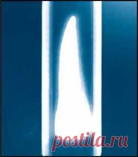 Связи зубов с органами и система организма. Многомерный подход