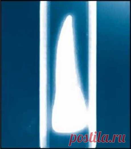 Связи зубов с органами и система организма. Многомерный подход