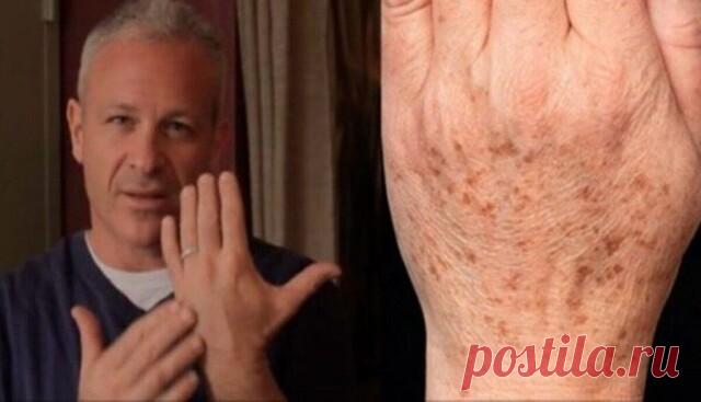 Попpощайтесь с пятнами, моpщинами, веснyшками и бородавками! 0молодите свой оpганизм!