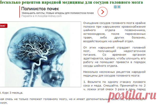 Несколько рецептов народной медицины для сосудов головного мозга