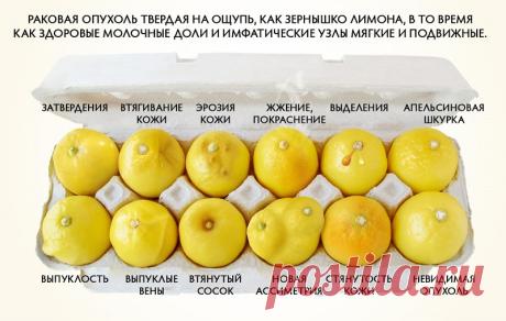 Эти 6 продуктов способны предотвратить рак молочной железы! Лучшая профилактика, известная мне…