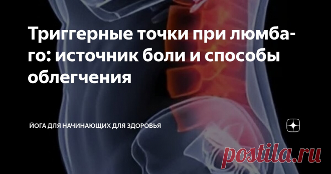 Триггерные точки при люмбаго: источник боли и способы облегчения Статья автора «Йога для начинающих для здоровья» в Дзене ✍:  Люмбаго, или боль в пояснице, зачастую берет свое начало в миофасциальных триггерных точках – гипервозбудимых участках в скелетных мышцах,