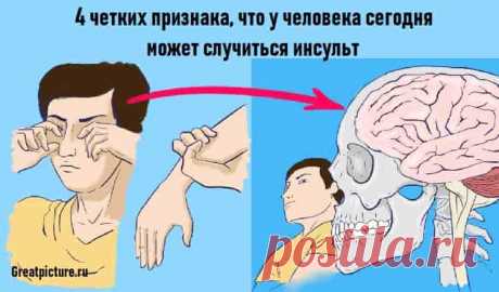 4 четких признака что у человека сегодня может случиться инсульт 4 четких признака что у человека сегодня может случиться инсульт.Вы отдыхаете в городском парке и вдруг видите, как один взрослый мирно