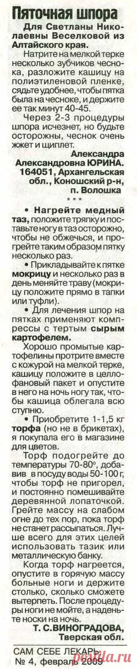 Пяточная шпора