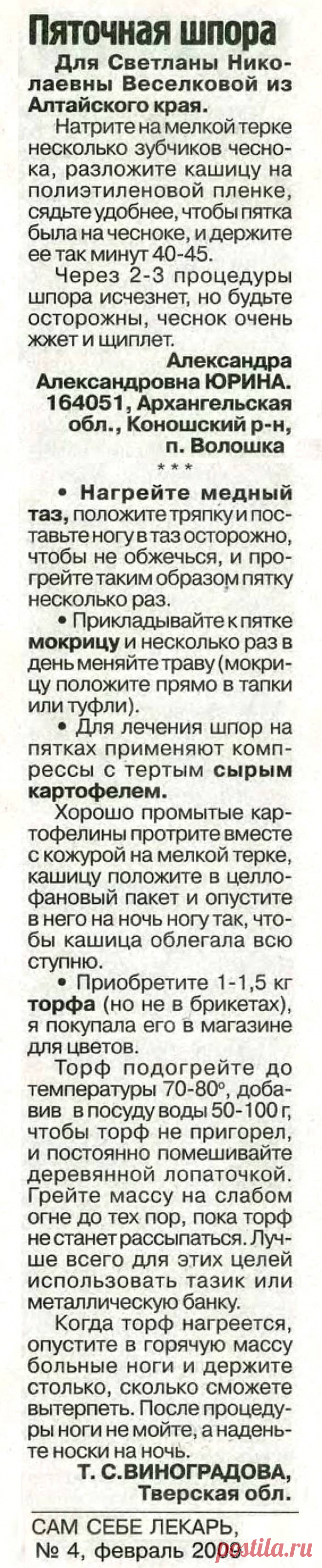 Пяточная шпора