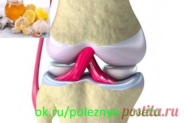 Это скрывали все хирурги! Так лечатся суставы дома за сутки