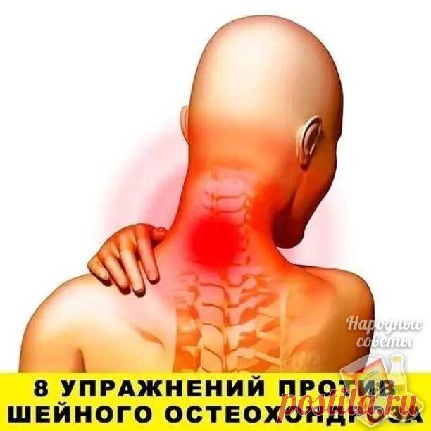 Первые проявления шейного остеохондроза — боли в спине, головные боли, головокружение, 