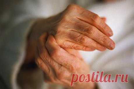 РЕВМАТОИДНЫЙ ПОЛИАРТРИТ. СИМПТОМЫ И ЛЕЧЕНИЕ