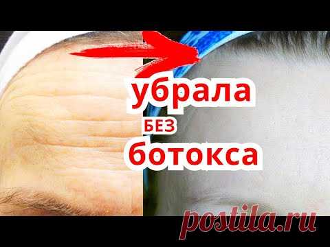 УБРАТЬ Морщины На Лбу БЕЗ Ботокса за 2 Дня