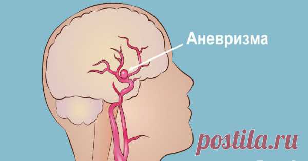 Эти 5 ингредиентов беспощадно разрушают мозг... Но многие из нас употребляют их каждый день! Вы, вероятно, едите эти 5 вещей каждый день, и все они повреждают ваш мозг. Пожалуйста, поделитесь с окружающими.