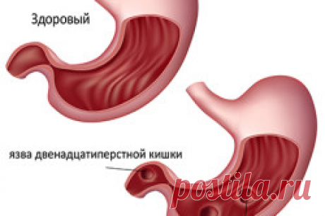 Мумие для желудка