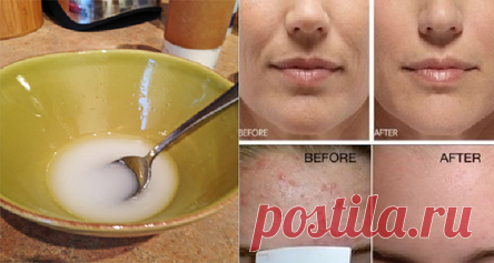 Попрощайтесь с морщинами и отшелушиванием кожи лица после умывания кокосовым маслом и содой!