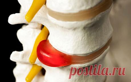 Боли в шее и спине