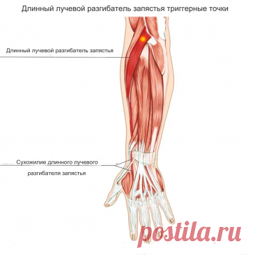 Длинный лучевой разгибатель запястья. Самомассаж