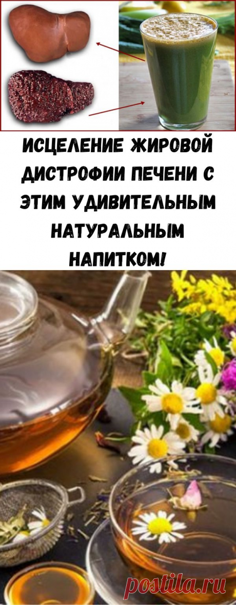 Исцеление жировой дистрофии печени с этим удивительным натуральным напитком! - Советы для тебя