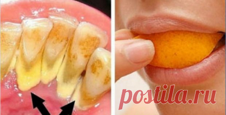 Будьте собственным стоматологом! Вот трюки, которые удалят накопление зубного камня в домашних условиях!
В наши дни зубной камень является очень распространенной проблемой. Это происходит из-за...
Читай дальше на сайте. Жми подробнее ➡