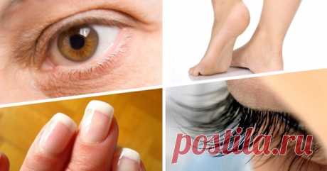 Касторовое масло против 17 недугов. Это больше чем просто косметологическое средство Хотя касторовое масло изготавливают из ядовитого растения под названием клещевина, не стоит опасаться за свое здоровье: при прессовании все опасные вещества остаются в отходах. Касторка — абсолютно бе…