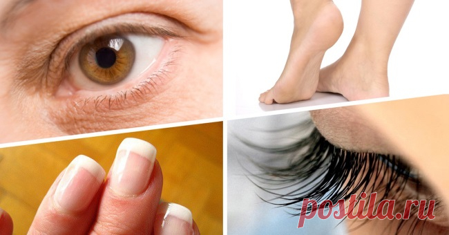 Касторовое масло против 17 недугов. Это больше чем просто косметологическое средство Хотя касторовое масло изготавливают из ядовитого растения под названием клещевина, не стоит опасаться за свое здоровье: при прессовании все опасные вещества остаются в отходах. Касторка — абсолютно бе…