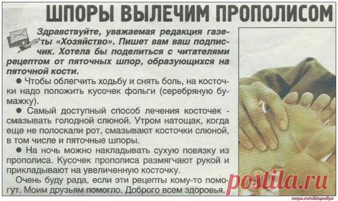 Шпоры, подагра