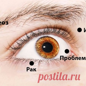 8 сигналов, при помощи которых глаза предупреждают о проблемах со здоровьем - МирТесен