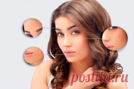 8 beauty-ошибок, виновных в появлении прыщей