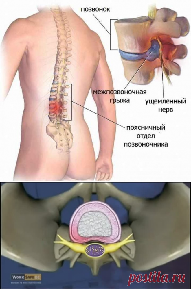 (94) Одноклассники
