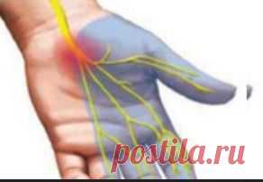 Лечение полинейропатии